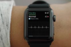 La función de electrocardiograma de Apple Watch incluida con watchOS 5.1.2