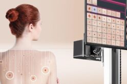 FotoFinder presenta la nueva generación de sistemas para la detección temprana del cáncer de piel